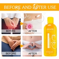 Feminine Hygiene Wash Intimate Wash Untuk  Gatal Kemaluan/ Berbau/ Gatal Celah Kangkang 150ml