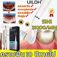 แก้ไขปัญหาฟันทั้งหมดใน 1 นาที UILDH เครื่องขูดหินปูนไฟฟ้า 31000ครั้ง/นาที ขจัดหินปูนและแคลคูลัสของฟัน เครื่องขัดฟัน ชุดขูดหินปูน ฟันทำความสะอาดเครื่องมือ เครื่องขุดหินปูน ขูดหินปูนเอง เครื่องขูดฟันไฟฟ้า ที่ขูดหินปูน เครื่องมือทันตกรรม เครื่องขัดหินปูน