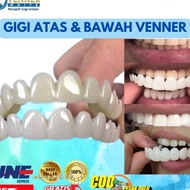 Termurah Venner White Gigi Palsu Original snap on smile Perpfect smile