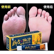 JIAOQIPIANFANG ANTI-BACTERIAL CREAM kaki atlet,anti kulat,melegakan sakit dan gatal