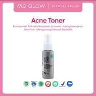 Toner Acne 60Ml -- Ms Glow