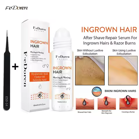 Razor Bumps Removal Solution Ingrowns Hair treatment Kit After Shave Repair Dark Spot Reduce Redness
