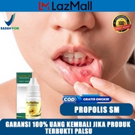Obat Sariawan / Sariawan Parah / Sariawan Berdarah / Radang Sariawan / Sariawan Susah Sembuh / Saria