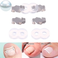 chenlongshang 1/2 Set Ingrown Toenail Corrector Tools Pedicure Recover Embed Toenail Treatment Foot 