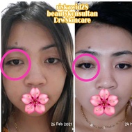 Eyegel anti Anging Drw skincare/Cream mata Drw skincare