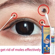 Ubat Buang Kutil ubat ketuat kutil ketuat tahi lalat biji kolestrol skin tag remover Warts removal c