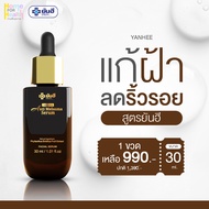 YANHEE ANTI MELASMA SERUM [1 ขวด] ยันฮี แอนตี้ เมลาสม่า เซรั่ม จากยันฮี ทาฝ้า ของแท้ ส่งฟรี!! เซรั่มฝ้า