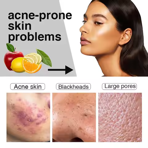 AILKE Tea Tree Oil Serum for Face and Body, Brightening, Moisturizing, Reduce Acne, With Vitamin E &
