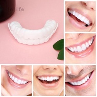 Snap On Smile    / Gigi Palsu Snapon Smile