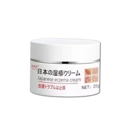 External Use Herbal Itching Extract Eczema Fu Skin Anti-Itching 25g Cream Cream 5.16 Cream Combat Ad