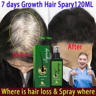 Jaysuing hair growth Spray Rambut Gugur hair growth tonic Hair Growth Serum Anti Hair Loss Products 