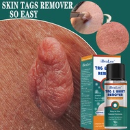 [Store Recommendation] iBeaLee Shuo Wo Xin Remove Warts Liquid Warts Flat Euro Sharp Warts Warts War