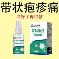 Shizhen Li Herpes Zoster Residual Neuralgia Gall Snake Ring Special Effect Detoxifying Ointment