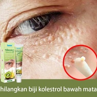 Vitamin E eye cream hilangkan biji kolestrol mata remove milia seed Fat granule of the skin around the eyes fat granule removal Eye Skin tags 20g
