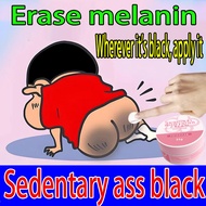miss v whitening neck knees Hip underarm whitening cream armpit whitening cream whitening cream priv