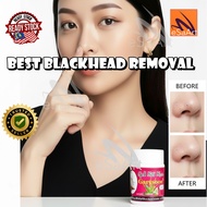 blackhead removal nose patch white aloe vera gel cleaning pore Garysoon acne 芦荟去黑头鼻贴
