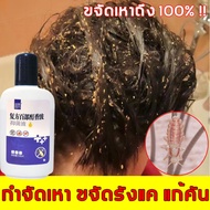 กําจัดเหาทั้งหมด! ยาฆ่าเหา 120ml กําจัดเหาและไข่เหา กําจัดปัญหาเหาสูตรอ่อนโยนไม่ระคายเคือง เหมาะสําหรับเด็กและหญิงตั้งครรภ์ แชมพูกำจัดเหา ยาฆ่าเหาถาวร แชมพูเหา แชมพูฆ่าเหา ยากำจัดเหาเด็ก ยาฆ่าเหาเด็ก ยาสระผมฆ่าเหา