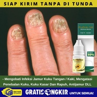 Gratis Ongkir!! Tetes Herbal Mengobati Jamur Kuku Yang Aman Ibu Hamil Pengobatan Infeksi Jamur Kuku