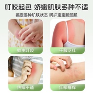 Sunflower Dingding Eliminating Soothing Cream Baby Children Mosquito Bites Mosquito Repellent Anti-i