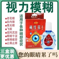 Eye Protection Student Vision Blurry Relieve Fatigue Eye Drop Eye Drop Eye Dry Eye Astringent Eye Fa