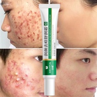 现货in stock【正品现货】泊蝶/温和芦荟祛痘霜祛痘膏 Acne Cream Mild Acne Cream Aloe Gel Skin Care Produ