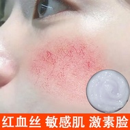 B5 B5 Repair Cream Sensitive Skin Repair Cream Remove Red Blood Soothing Redness Repair Skin Barrier