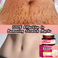 Stretch Mark Remover 30g Anti stretch mark cream Scar Stretch mark removal Maternity Stretch mark cr