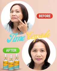 Buy 1 Take 1 Original Belo Time Capsule Advcance Treatment Serum for Acne Wrinkles Dark Spots Melasm