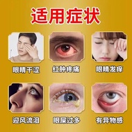 炎结膜炎眼药水止痒消炎杀菌眼睛干涩发痒眼痒药沙眼滴眼液眼药水             tdjyd666.my20260421
