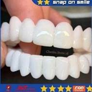 snap on smile asli