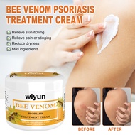Bee Venom Psoriasis Cream Repairs Red And Itchy Skin On Hands And Feet Moisturizes And Smoothes Skin Care Cream