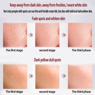 ♞Dark Spot Remover Brightest Skin Anti Aging Pekas Remover Original Pynocare for Melasma Cream 30g