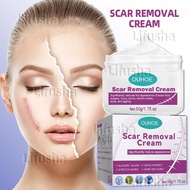 Scar Removal Cream Scarminator Cream Peklat Remover Acne Treatment Scar Stretch Mark Cream skin care