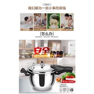 Jinmei Stainless Steel Pressure Cooker304Explosion-Proof Pot Induction Cooker Open Flame Universal Mini Household Pressure Cooker16-32cm