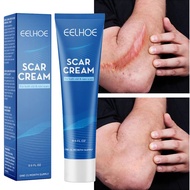 EELHOE SCAR CREAM FOR BOTH OLD&amp;NEW