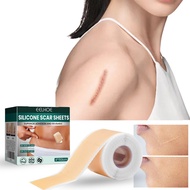 Silicone Scar Sheet 4x150cm Scar Sheet Silicone For Acne Burn Repair Fade All Kinds Of Scars