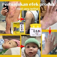 ORIGINAL BAI YAO LANG ANTIBACTERIAL CREAM krim antibakteria rawat kulit gatal kering berair merah ku