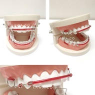 Thailook Braces Click Viral Sepasang | Atas & Bawah