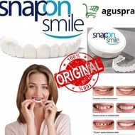 Xapxsnap On Smile 1 Set Dental Veneer / Best Selling Health / Health Care
