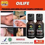 BENJOLAN 5 HARI LANGSUNG HILANG !! OILIFE MINYAK OLES UNTUK BENJOLAN | OBAT BENJOLAN | OBAT BENJOLAN