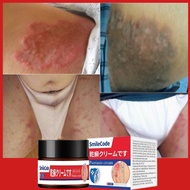 Psoriasis Cream Antifungal cream Eczema cream Cream gatal kulit 30g krim gatal kulit herba cina Ubat