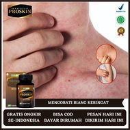 MERAH Medicine For Sweating, Medicine For Body Sweat, Medicine For Itching Bruntusan, Medicine For I