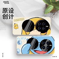 Suitable for Glory magic7 Phone Case Glory magic7pro Protective Case Huawei Magic 7 Shell Men Women 