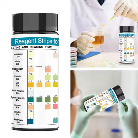 100 Strips Urine Test Strip 10 Parameters Urine Urinalysis Test Strips Leukocytes Nitrite Urobilinog