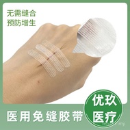 Pita Tanpa Jahitan Luka Tampalan Penyembuhan Jahitan Luka Pasca Operasi Stapler Menarik Pita Tampala