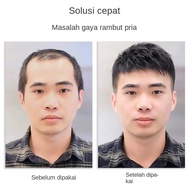 COD-Rambut gimbal pria dengan potongan rambut pendek tanpa bekas tidak terlihat rambut botak yang ba