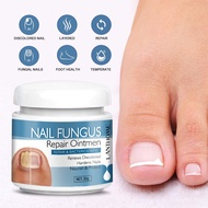 NAIL FUNGUS Repair Ointment✅7Days Stop Gray Nails✅8Weeks Recovery✅Salicylic Acid+Kuh-sengAnti-Itch&C