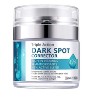 Dark Spot Remover for Face and Body, Dark Spot Corrector Cream, Dark Spot Corrector Cream for Age Sp