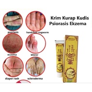 RAMUAN HERBA MUJARAB KRIM GATAL TABIB CINA KRIM PUTIH HERBA