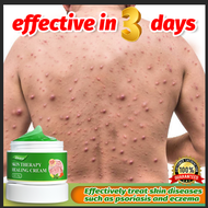 gamot sa kati kati sa balat ointments for skin deases eczema treatment anti bacterial fungal dermaca